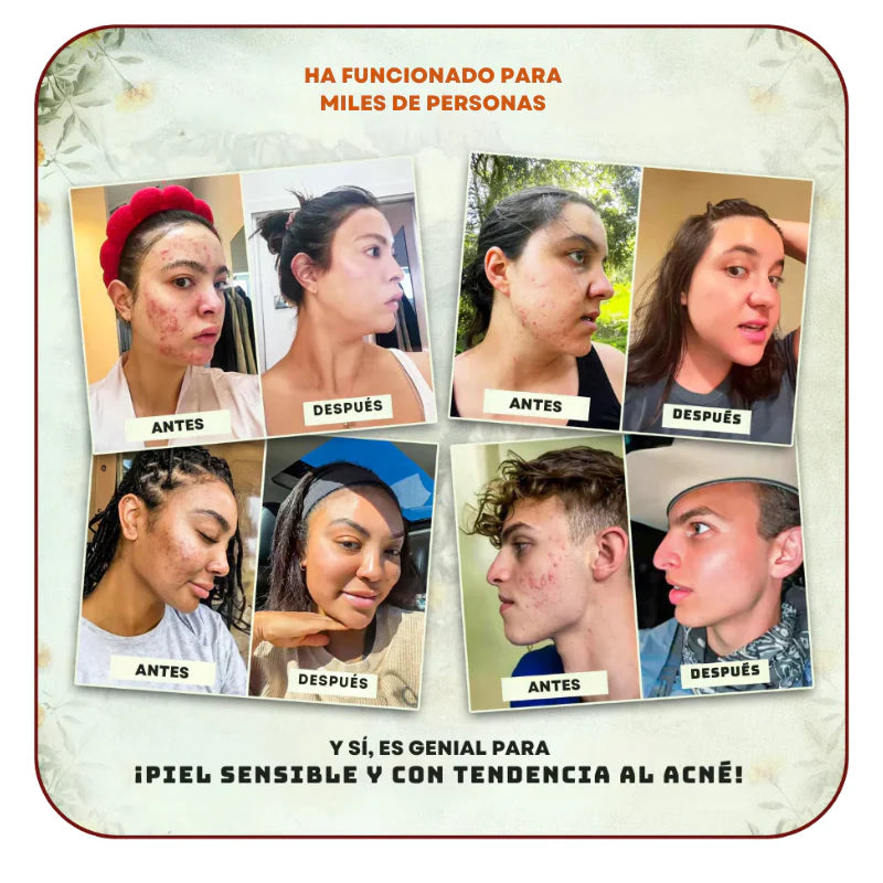 Black Friday 🔥 1 + 1 GRATIS - El Bálsamo Natural Más Vendido Avora Store