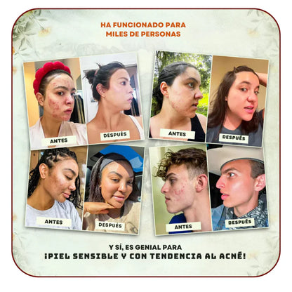 Black Friday 🔥 1 + 1 GRATIS - El Bálsamo Natural Más Vendido  Avora Store