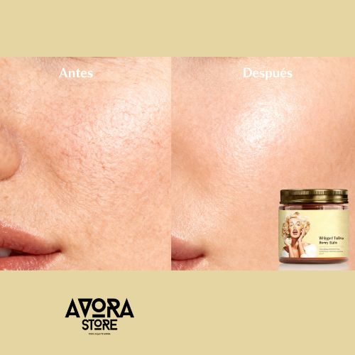 Black Friday 🔥 1 + 1 GRATIS - El Bálsamo Natural Más Vendido  Avora Store